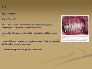 c/f –
Age – older pts
Sex – F:M – 2:1
Site – oral lesions, involvement of conjunctiva, nasal,
Esophagus, laryngeal & vaginal mucosa
Becoz the blisters are subepith – produces a thick strong
Roof
Later – blisters rupture leaving large, superficial ulcerations,
& denuded areas of mucosa
Ulcerations – painful & persists for weeks
 