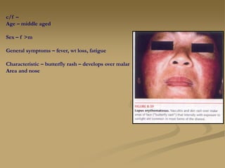 c/f –
Age – middle aged
Sex – f >m
General symptoms – fever, wt loss, fatigue
Characteristic – butterfly rash – develops over malar
Area and nose
 