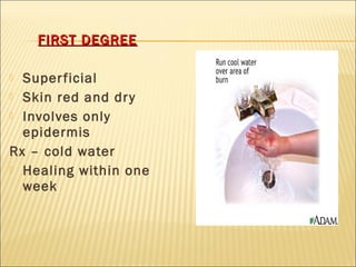 FIRST DEGREEFIRST DEGREE
 Superficial
 Skin red and dry
 Involves only
epidermis
Rx – cold water
 Healing within one
week
 