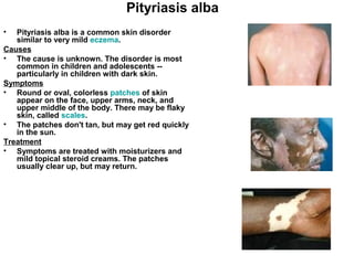 Pityriasis alba is a common skin disorder similar to very mild  eczema . Causes The cause is unknown. The disorder is most common in children and adolescents -- particularly in children with dark skin. Symptoms Round or oval, colorless  patches  of skin appear on the face, upper arms, neck, and upper middle of the body. There may be flaky skin, called  scales . The patches don't tan, but may get red quickly in the sun. Treatment Symptoms are treated with moisturizers and mild topical steroid creams. The patches usually clear up, but may return. Pityriasis alba 