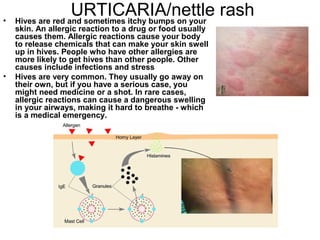URTICARIA/nettle rash Hives are red and sometimes itchy bumps on your skin. An allergic reaction to a drug or food usually causes them. Allergic reactions cause your body to release chemicals that can make your skin swell up in hives. People who have other allergies are more likely to get hives than other people. Other causes include infections and stress  Hives are very common. They usually go away on their own, but if you have a serious case, you might need medicine or a shot. In rare cases, allergic reactions can cause a dangerous swelling in your airways, making it hard to breathe - which is a medical emergency. 