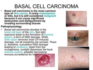 BASAL CELL CARCINOMA Basal cell carcinoma is the most common type of  skin cancer . It rarely  metastasizes  or kills, but it is still considered  malignant  because it can cause significant destruction and disfigurement by invading surrounding tissues   Pathophysiology     Basal cell carcinomas develop in the  basal cell layer  of the  skin . Sun light exposure leads to the formation of  thymine  dimers , a form of DNA damage. While  DNA repair  removes most UV-induced damage, not all crosslinks are excised. There is, therefore, cumulative DNA damage leading to  mutations . Apart from the mutagenesis, sunlight depresses the local  immune system , possibly decreasing immune surveillance for new tumor cells. 