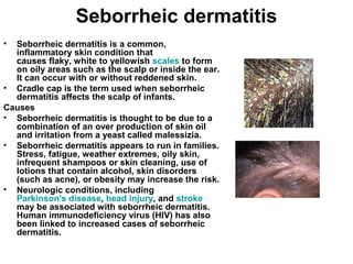 Seborrheic dermatitis Seborrheic dermatitis is a common, inflammatory skin condition that causes flaky, white to yellowish  scales  to form on oily areas such as the scalp or inside the ear. It can occur with or without reddened skin. Cradle cap is the term used when seborrheic dermatitis affects the scalp of infants. Causes Seborrheic dermatitis is thought to be due to a combination of an over production of skin oil and irritation from a yeast called malessizia. Seborrheic dermatitis appears to run in families. Stress, fatigue, weather extremes, oily skin, infrequent shampoos or skin cleaning, use of lotions that contain alcohol, skin disorders (such as acne), or obesity may increase the risk. Neurologic conditions, including  Parkinson's disease ,  head injury , and  stroke  may be associated with seborrheic dermatitis. Human immunodeficiency virus (HIV) has also been linked to increased cases of seborrheic dermatitis. 