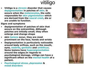 vitiligo Vitiligo is a  chronic  disorder that causes  depigmentation  in patches of  skin . It occurs when the  melanocytes , the cells responsible for  skin pigmentation  which are derived from the  neural crest , die or are unable to function.  Signs and symptoms depigmentation of patches of skin that occurs on the extremities. Although patches are initially small, they often enlarge and change shape  skin  lesions  occur, they are most prominent on the face, hands and wrists  Depigmentation is particularly noticeable around body orifices, such as the mouth, eyes,  nostrils ,  genitalia  and  umbilicus . Some lesions have  hyperpigmentation  around the edges.In regards to psychological damage, vitiligo can have a significant effect on the  mental health  of a patient. Psychological stress  , depression  &  mood disorders 
