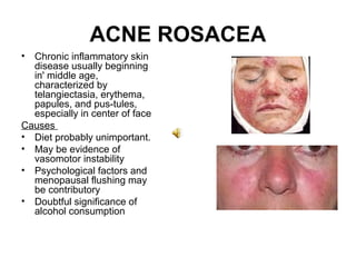 ACNE ROSACEA Chronic inflammatory skin disease usually beginning in' middle age, characterized by telangiectasia, erythema, papules, and pus­tules, especially in center of face Causes  Diet probably unimportant. May be evidence of vasomotor instability Psychological factors and menopausal flushing may be contributory Doubtful significance of alcohol consumption 