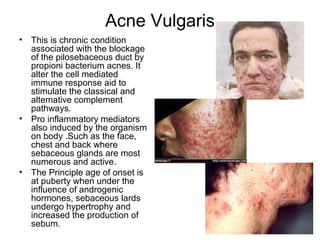 Acne Vulgaris This is chronic condition associated with the blockage of the pilosebaceous duct by propioni bacterium acnes. It alter the cell mediated immune response aid to stimulate the classical and altemative complement pathways. Pro inflammatory mediators also induced by the organism on body .Such as the face, chest and back where sebaceous glands are most numerous and active. The Principle age of onset is at puberty when under the influence of androgenic hormones, sebaceous lards undergo hypertrophy and increased the production of sebum. 