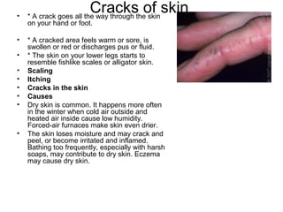 Cracks of skin  * A crack goes all the way through the skin on your hand or foot.  * A cracked area feels warm or sore, is swollen or red or discharges pus or fluid.  * The skin on your lower legs starts to resemble fishlike scales or alligator skin.  Scaling   Itching  Cracks in the skin  Causes Dry skin is common. It happens more often in the winter when cold air outside and heated air inside cause low humidity. Forced-air furnaces make skin even drier. The skin loses moisture and may crack and peel, or become irritated and inflamed. Bathing too frequently, especially with harsh soaps, may contribute to dry skin.  Eczema  may cause dry skin. 