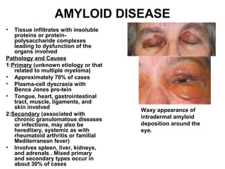 AMYLOID DISEASE Tissue infiltrates with insoluble proteins or protein-polysaccharide complexes leading to dysfunction of the organs involved Pathology and Causes 1: Primary  (unknown etiology or that related to multiple myeloma) Approximately 70% of cases Plasma-cell dyscrasia with Bence Jones pro­tein Tongue, heart, gastrointestinal tract, muscle, ligaments, and skin involved 2: Secondary  (associated with chronic granulomatous diseases or infections, may also be hereditary, systemic as with rheumatoid arthritis or familial Mediterranean fever) Involves spleen, liver, kidneys, and adrenals . Mixed primary and secondary types occur in about 30% of cases Waxy appearance of intradermal amyloid deposition around the eye.   