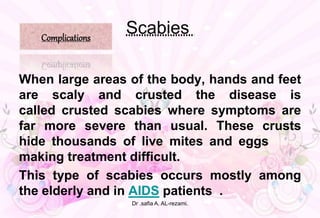 Scabies
When large areas of the body, hands and feet
are scaly and crusted the disease is
called crusted scabies where symptoms are
far more severe than usual. These crusts
hide thousands of live mites and eggs ,
making treatment difficult.
This type of scabies occurs mostly among
the elderly and in AIDS patients . .
Complications
Dr .safia A. AL-rezami.
 