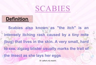 SCABIES
Scabies also known as "the itch" is an
intensely itching rash caused by a tiny mite
(bug) that lives in the skin. A very small, hard
to see, zigzag blister usually marks the trail of
the insect as she lays her eggs
Definition:
Dr .safia A. AL-rezami.
 