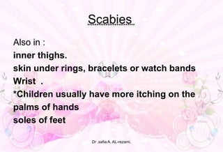 Scabies
Also in :
inner thighs.
skin under rings, bracelets or watch bands
Wrist .
*Children usually have more itching on the
palms of hands
soles of feet
Dr .safia A. AL-rezami.
 