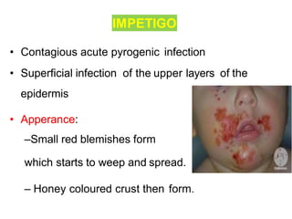 REVIEW OF SKIN DISORDER | PPTX