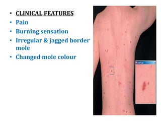 Skin disorder | PPTX