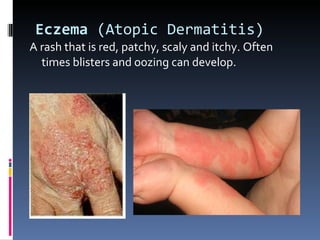 Skin disorders | PPT