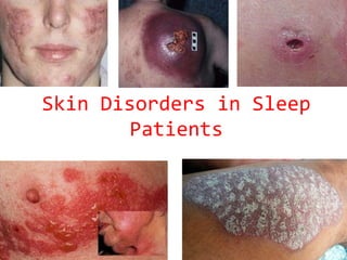 Skin Disorders in Sleep Patients 