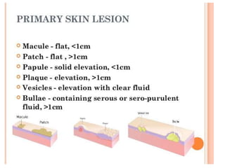 PRIMARY SKIN LESSIONS
 
