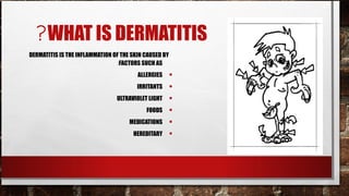 ?WHAT IS DERMATITIS
DERMATITIS IS THE INFLAMMATION OF THE SKIN CAUSED BY
                                :FACTORS SUCH AS
                                        ALLERGIES      •
                                        IRRITANTS      •
                                ULTRAVIOLET LIGHT      •
                                           FOODS       •
                                     MEDICATIONS       •
                                      HEREDITARY       •
 