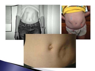 Endocrine Rashes Skin or Dermatological Manifestations of Endocrine Diseases | PPTX