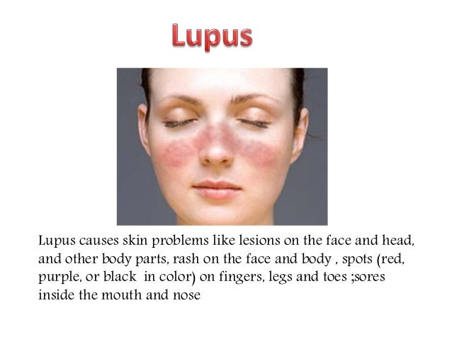 Skin disorders and their treatment
