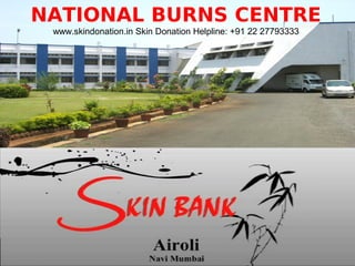 •
NATIONAL BURNS CENTRE
www.skindonation.in Skin Donation Helpline: +91 22 27793333
 