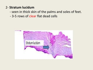2- Stratum lucidum
- seen in thick skin of the palms and soles of feet.
- 3-5 rows of clear flat dead cells
 