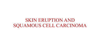 SKIN ERUPTION AND
SQUAMOUS CELL CARCINOMA
 