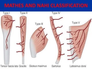 MATHES AND NAHI CLASSIFICATION
 