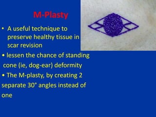M-Plasty
• A useful technique to
preserve healthy tissue in
scar revision
• lessen the chance of standing
cone (ie, dog-ear) deformity
• The M-plasty, by creating 2
separate 30° angles instead of
one
 