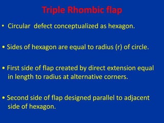 Triple Rhombic flap
• Circular defect conceptualized as hexagon.
• Sides of hexagon are equal to radius (r) of circle.
• First side of flap created by direct extension equal
in length to radius at alternative corners.
• Second side of flap designed parallel to adjacent
side of hexagon.
 