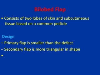 Bilobed Flap
• Consists of two lobes of skin and subcutaneous
tissue based on a common pedicle
Design
– Primary flap is smaller than the defect
– Secondary flap is more triangular in shape
•
 