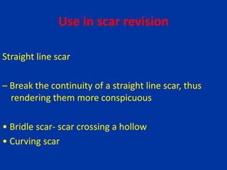 Use in scar revision
Straight line scar
– Break the continuity of a straight line scar, thus
rendering them more conspicuous
• Bridle scar- scar crossing a hollow
• Curving scar
 
