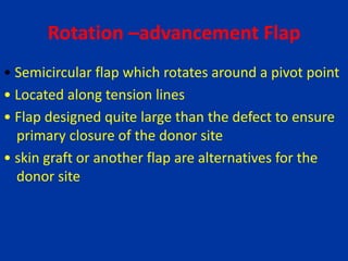 Rotation –advancement Flap
• Semicircular flap which rotates around a pivot point
• Located along tension lines
• Flap designed quite large than the defect to ensure
primary closure of the donor site
• skin graft or another flap are alternatives for the
donor site
 