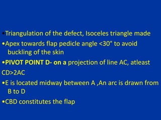 •Triangulation of the defect, Isoceles triangle made
•Apex towards flap pedicle angle <30° to avoid
buckling of the skin
•PIVOT POINT D- on a projection of line AC, atleast
CD>2AC
•E is located midway between A ,An arc is drawn from
B to D
•CBD constitutes the flap
 