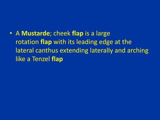 • A Mustarde; cheek flap is a large
rotation flap with its leading edge at the
lateral canthus extending laterally and arching
like a Tenzel flap
 