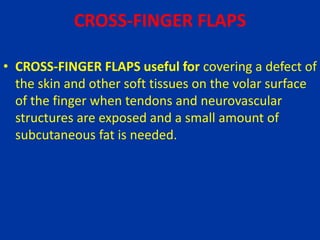 CROSS-FINGER FLAPS
• CROSS-FINGER FLAPS useful for covering a defect of
the skin and other soft tissues on the volar surface
of the finger when tendons and neurovascular
structures are exposed and a small amount of
subcutaneous fat is needed.
 