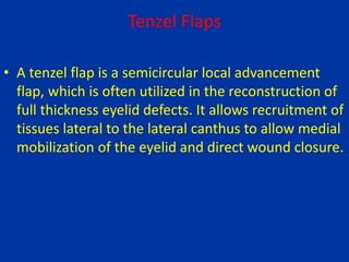 Tenzel Flaps
• A tenzel flap is a semicircular local advancement
flap, which is often utilized in the reconstruction of
full thickness eyelid defects. It allows recruitment of
tissues lateral to the lateral canthus to allow medial
mobilization of the eyelid and direct wound closure.
 