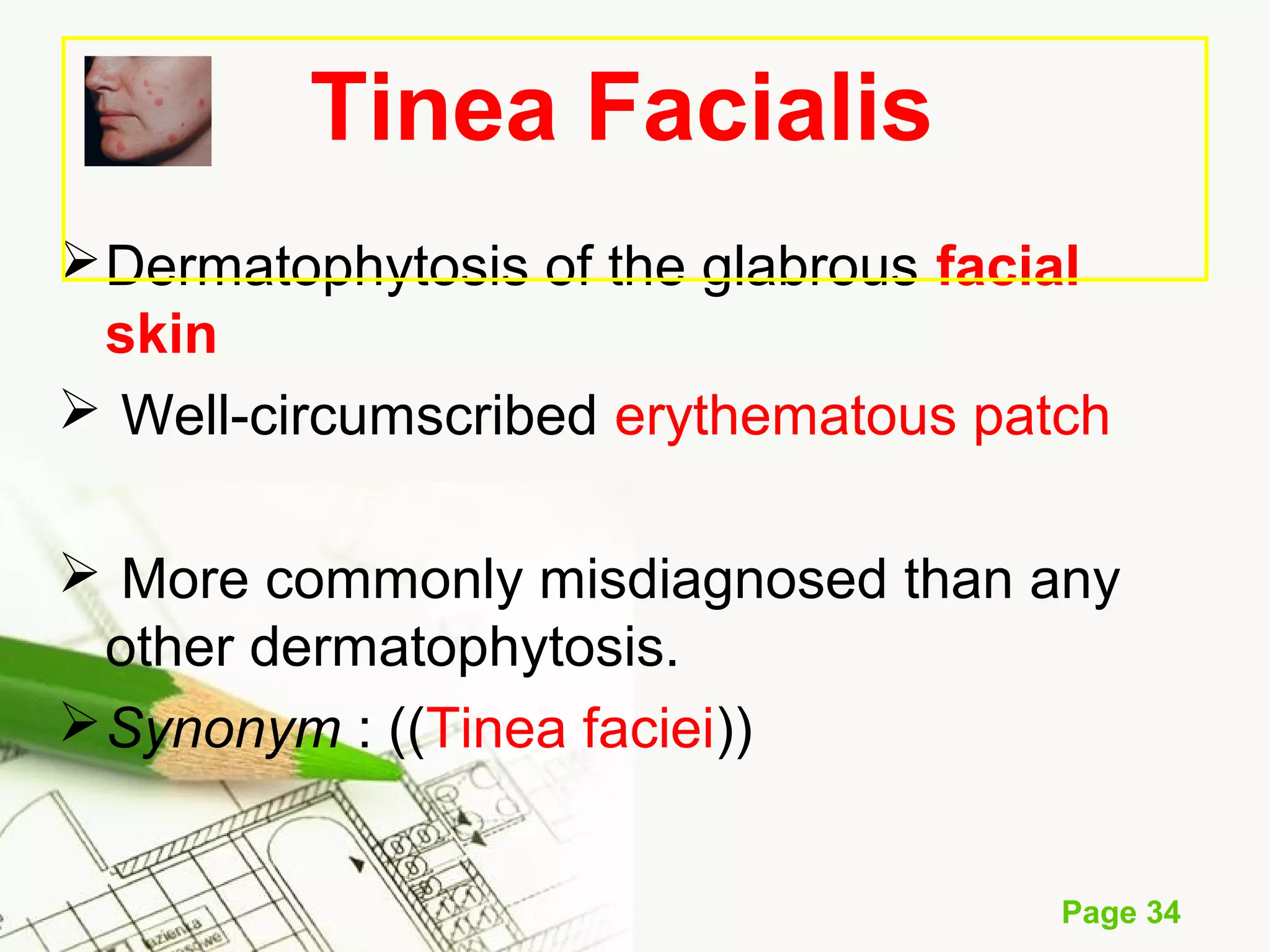 Skin fungal infection | PPT