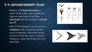 Skin graft and Flap surgery | PPTX