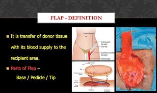 Skin Graft & Flap - Types, Technique, Advantages & Disadvantages | PDF