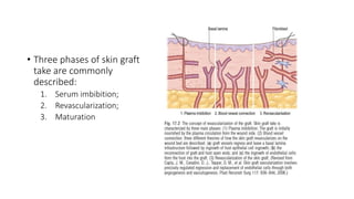 Brief Anatomy of Skin and Skin Grafting | PPTX