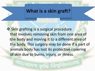 Skin Grafting.pptx