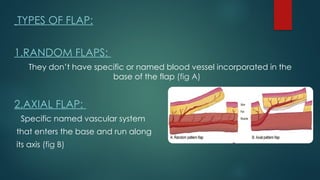 SKIN GRAFTING AND TISSUE FLAP nnnnnn.pptx