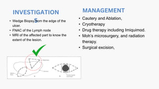 INVESTIGATION
S
MANAGEMENT
• Wedge Biopsy from the edge of the
ulcer.
• FNAC of the Lymph node
• MRI of the affected part to know the
extent of the lesion.
• Cautery and Ablation,
• Cryotherapy
• Drug therapy including Imiquimod.
• Moh’s microsurgery, and radiation
therapy.
• Surgical excision,
 