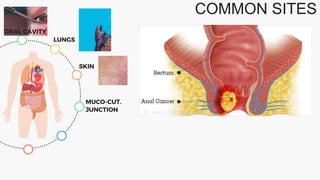 COMMON SITES
ORAL CAVITY
LUNGS
SKIN
MUCO-CUT.
JUNCTION
 
