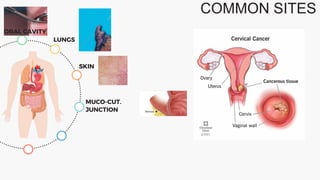 COMMON SITES
ORAL CAVITY
LUNGS
SKIN
MUCO-CUT.
JUNCTION
 