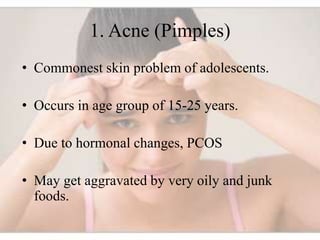 Students Skin Problems Skin, Hair and nail care for college students 3.pptx