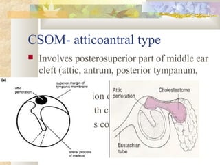 Eye and ear problems | PPT