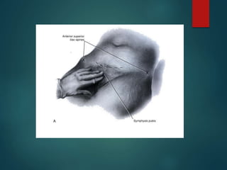 Testopel Incision Site Skin incisions final | PPTX