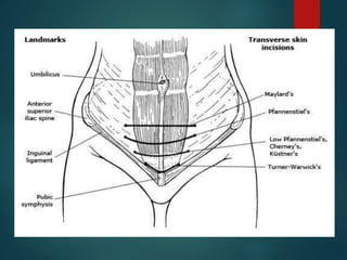 Skin incisions final | PPTX