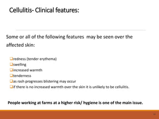 Cellulitis- Clinical features:
Some or all of the following features may be seen over the
affected skin:
redness (tender erythema)
swelling
increased warmth
tenderness
as rash progresses blistering may occur
if there is no increased warmth over the skin it is unlikely to be cellulitis.
People working at farms at a higher risk/ hygiene is one of the main issue.
32
 